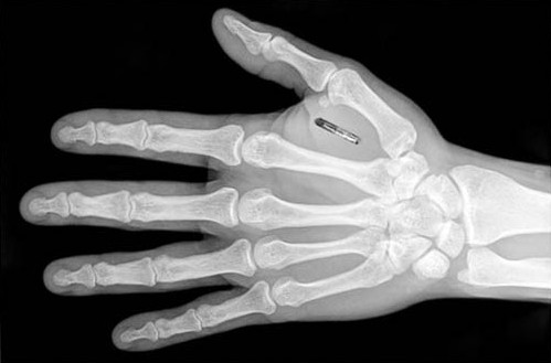 柔性電路板廠家